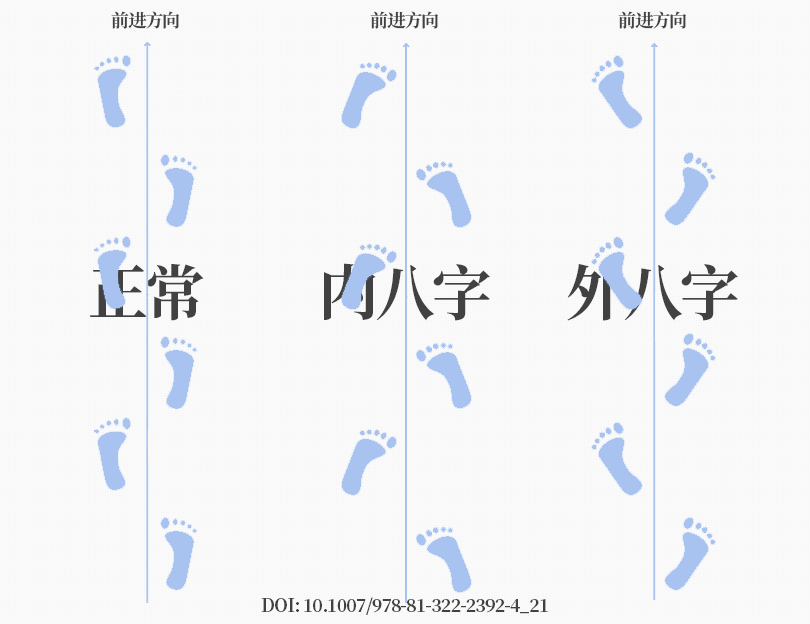 足底壓力分布計(jì)量